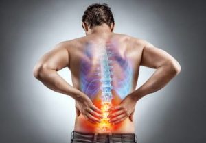 Bandscheibenvorfall Rückenschmerzen